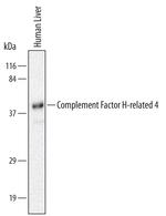 CFHR4 Antibody in Western Blot (WB)