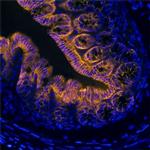 TSPAN8 Monoclonal Antibody (657909)