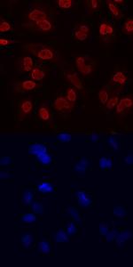 RCOR1 Antibody in Immunocytochemistry (ICC/IF)