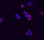 RARRES3 Monoclonal Antibody (659209)