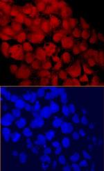 CHD1 Antibody in Immunocytochemistry (ICC/IF)