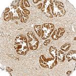 Tensin 4 Antibody in Immunohistochemistry (Paraffin) (IHC (P))