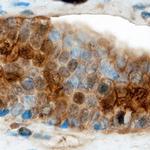 Claudin 19 Monoclonal Antibody (693202)