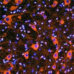 VAPB Monoclonal Antibody (699811)