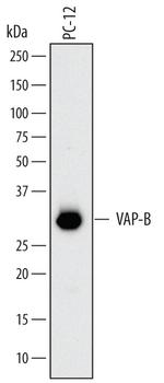 VAPB Antibody in Western Blot (WB)