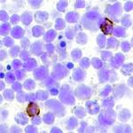 CLEC9A Monoclonal Antibody (700517)