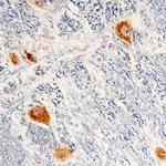 Cerebellin 2 Monoclonal Antibody (704323)