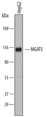 MGAT5 Antibody in Western Blot (WB)