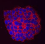 Arylsulfatase B Monoclonal Antibody (708401)