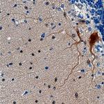 SHANK2 Monoclonal Antibody (711924)