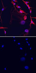ST6GALNAC5 Monoclonal Antibody (719508)