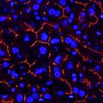 CEACAM1 Monoclonal Antibody (723629)