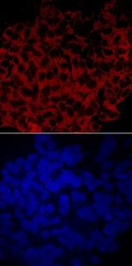 GBA3 Monoclonal Antibody (728702)