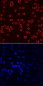 EMP Antibody in Immunocytochemistry (ICC/IF)