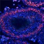 TDRD1 Monoclonal Antibody (739206)