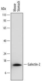 Galectin 2 Antibody in Western Blot (WB)