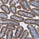 Angiotensinogen Monoclonal Antibody (754438)