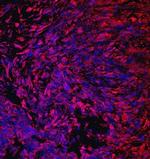 CRTAC1 Monoclonal Antibody (755315)