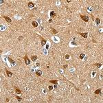 LRRC4C Monoclonal Antibody (755720)