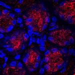 GKN1 Monoclonal Antibody (759821)