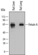 Fetuin A Monoclonal Antibody (774761)