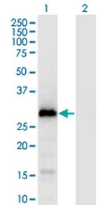 GAGE1 Monoclonal Antibody (4G6)