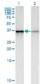 PHC2 Monoclonal Antibody (1F4)