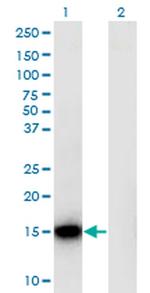 RPLP1 Antibody in Western Blot (WB)
