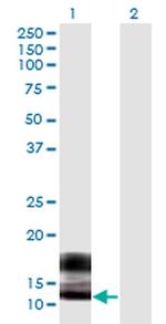 SPRR2F Monoclonal Antibody (5A9)