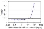 FIBP Antibody in ELISA (ELISA)