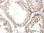 NOL4 Antibody in Immunohistochemistry (Paraffin) (IHC (P))