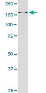 RAI1 Monoclonal Antibody (6H5)