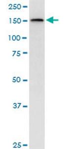 TOPBP1 Monoclonal Antibody (6D12)