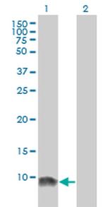 LSM6 Antibody in Western Blot (WB)