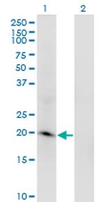 ARL2BP Monoclonal Antibody (2G6)
