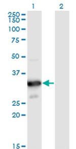 MYOZ2 Monoclonal Antibody (1D4)