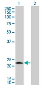 RNFT1 Monoclonal Antibody (4H7)