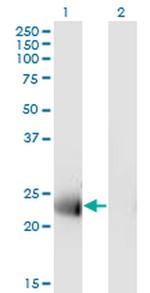 MS4A12 Monoclonal Antibody (4F4)