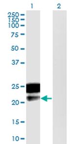 DMRTB1 Monoclonal Antibody (5E7)