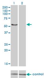 IRX6 Monoclonal Antibody (1A5)