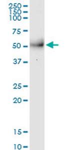 MPPE1 Monoclonal Antibody (3E4)