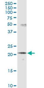 SCNM1 Monoclonal Antibody (1E10)