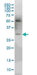 PLEKHO2 Antibody in Western Blot (WB)