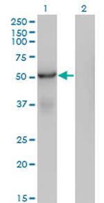 SNX25 Monoclonal Antibody (3A8)