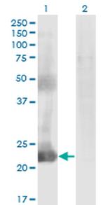 CCDC115 Antibody in Western Blot (WB)