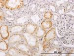 ACCS Antibody in Immunohistochemistry (Paraffin) (IHC (P))