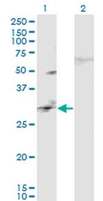 CAPS2 Antibody in Western Blot (WB)