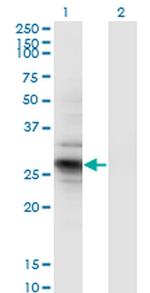 IDI2 Monoclonal Antibody (1C11)