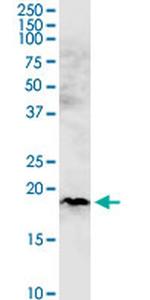 CHCHD4 Monoclonal Antibody (6C9)