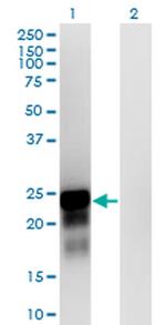 SPANXN3 Monoclonal Antibody (1F11)